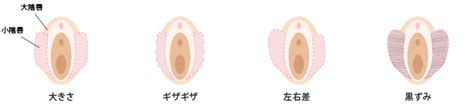 福岡で小陰唇縮小手術をしたい方へ Wクリニック福岡院 美容皮膚科・美容外科・美容内科