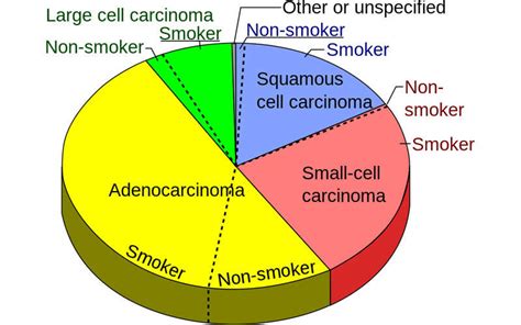 Ninety percent of lung cancers can be prevented by completely giving up tobacco. Portrazza (necitumumab) for the Treatment of Metastatic ...