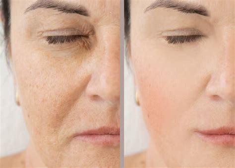 Skin Revitalization Stock Photos Pictures And Royalty Free Images Istock