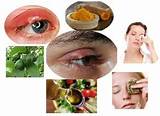 Pictures of Bright Eyes Home Remedies