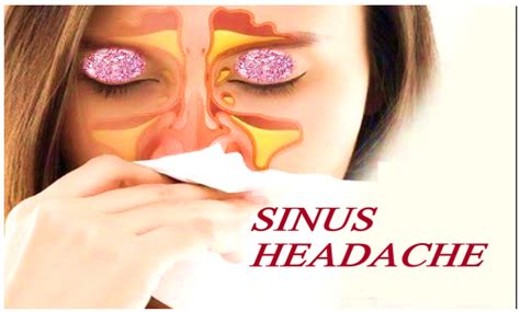 Dont Take Sinus Headaches Easily Detailed Guide Dr Meenesh