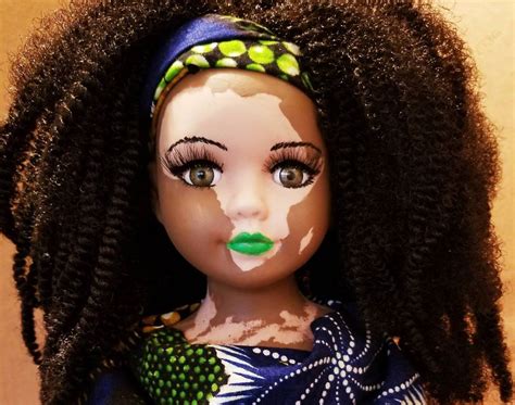 Artist Creates Dolls With Vitiligo For Kids With This Rare Skin