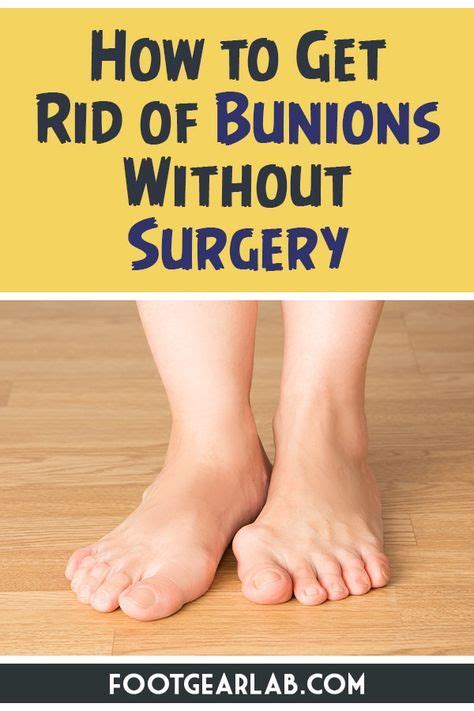 The bunion causes the end of the big toe to bend toward the other toes and. How To Get Rid Of Bunions Without Surgery In 12 Easy Ways ...