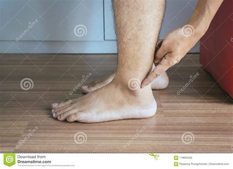 Man Dry Skin Or Pigmentation On Feet With Ankleboneclose Upskin