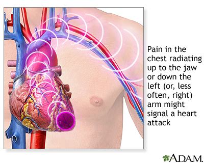 I have been having some pain under my left rib, and i wanted to know if your heart is under your left rib cage, or if their were any arteryies under the left rib cage. Chest pain | Healthing.ca