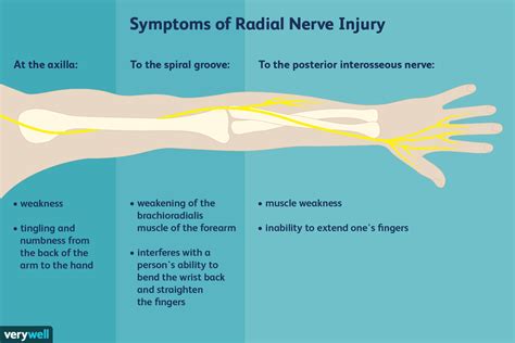 Radial Nerve Anatomy Function And Treatment
