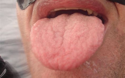 7 Strange Signs You're Having an Allergic Reaction | Live Science