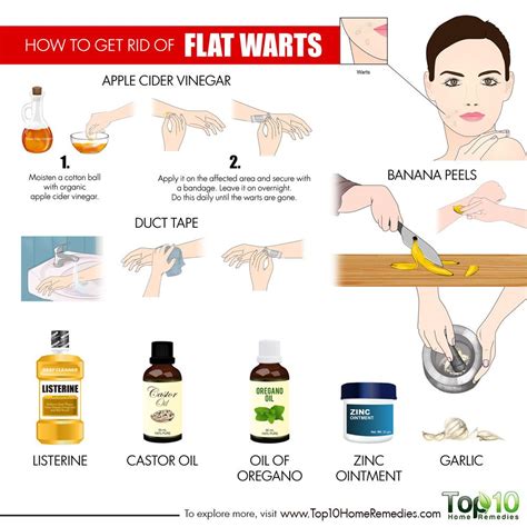 How To Get Rid Of Flat Warts Top 10 Home Remedies Flat Warts Home