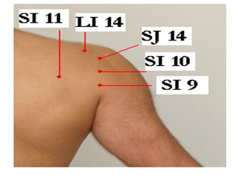 17 Acupuncture And Frozen Shoulder Shoulder Pain 1 Jun Xu Md 203