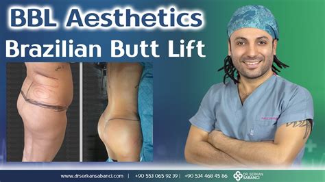 Bbl Aesthetics Brazilian Butt Lift Op Dr Serkan Sabancı Youtube