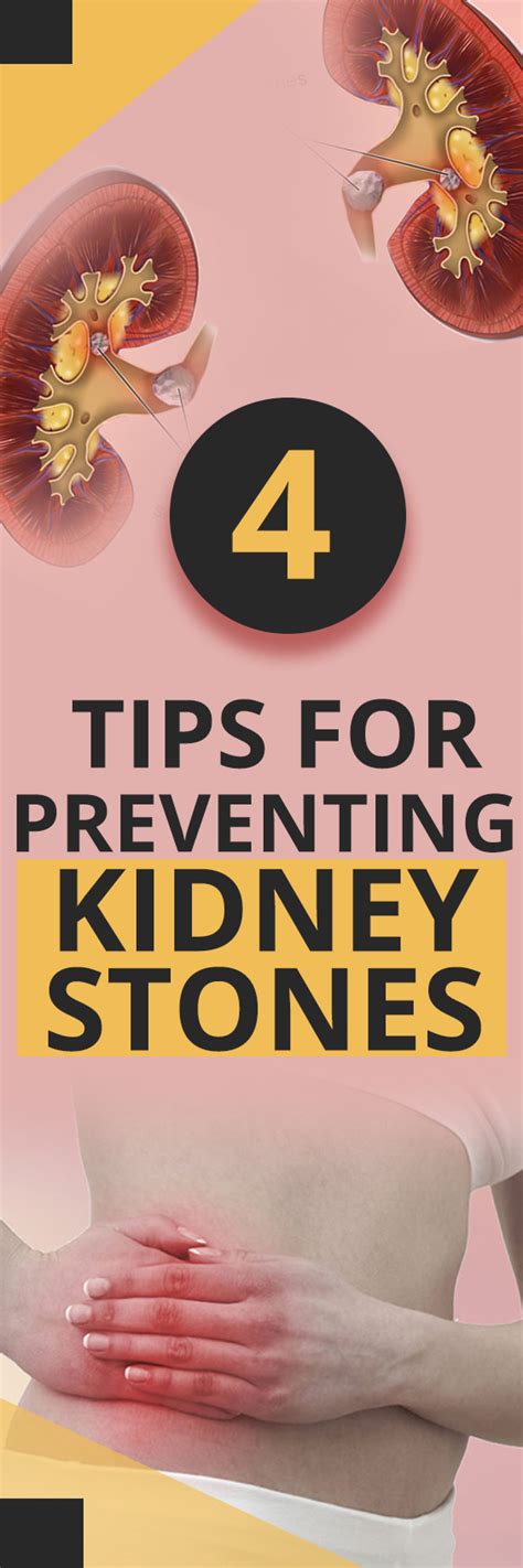 4 Tips For Preventing Kidney Stones