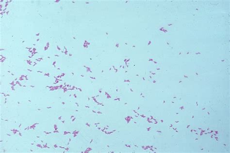 Campylobacter Jejuni Gram Stain The Small Gram Negative Rods Are