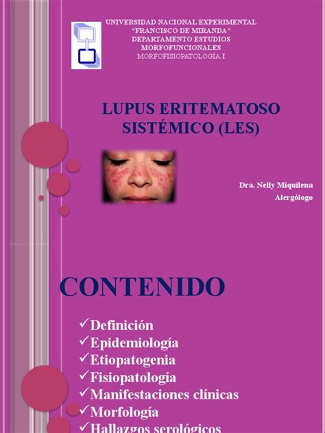 Lupus Eritematoso Sistémico Les Pdf