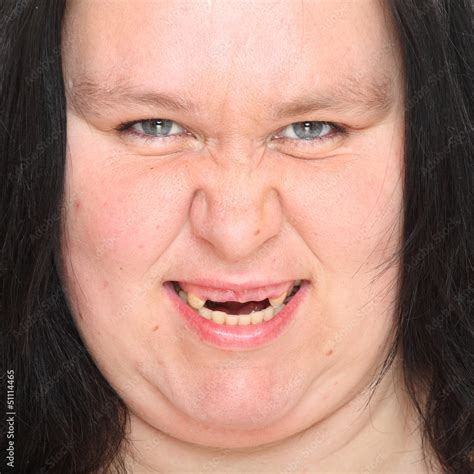 Obese Woman With Missing Teeth 스톡 사진 Adobe Stock