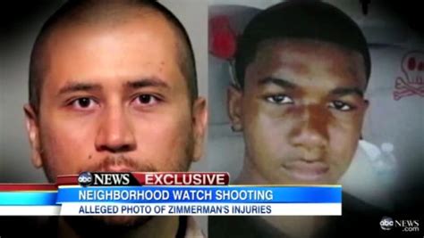 George Zimmerman Photo Shows Bloody Head May Bolster Self Defense