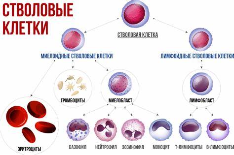 Множественная миелома диета Множественная миелома Множественная миелома Множественная миелома диета