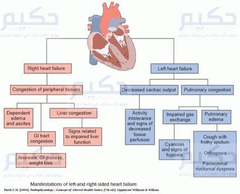 To evade by putting aside or ignoring: left vs right sided heart failure | Heart Failure | حكيم ...
