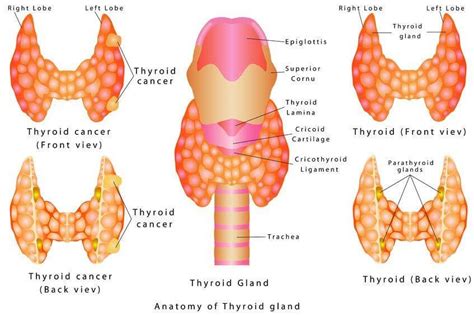 Thyroid Specialist Chicago Parathyroid Chicago Chicago Ent