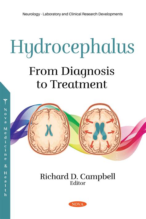 Hydrocephalus From Diagnosis To Treatment Nova Science Publishers