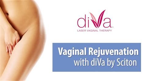 Vaginal Rejuvenation Without Surgery Youtube