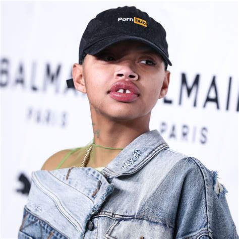 Model Slick Woods Suffers Seizure Shows Swollen Face And Lips On Instagram