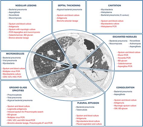 Classification Of Interstitial Lung Disease