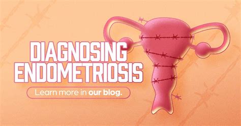 Diagnosing Endometriosis Seattle Clinical Research Center