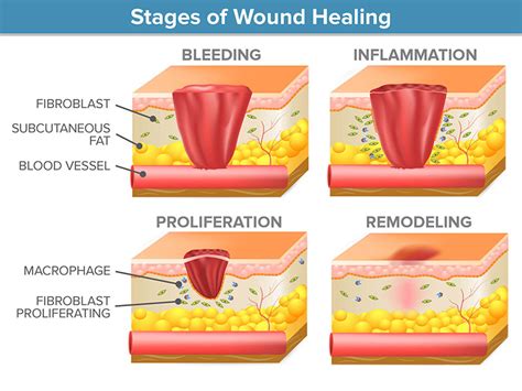 How Do Wounds Heal Scientific Scribbles