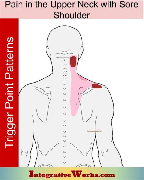 Pain Between Shoulder Blades Pain Patterns Causes Self Care