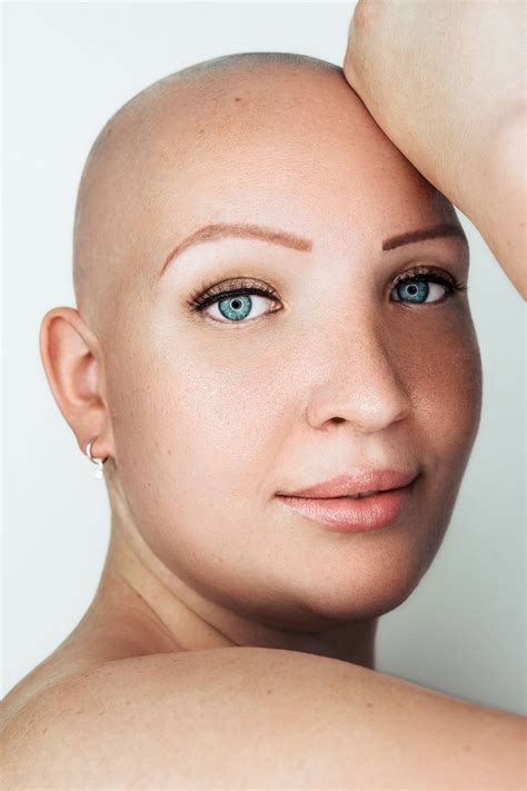 Alopecia Model Leonie B Bei Fameonme Casting