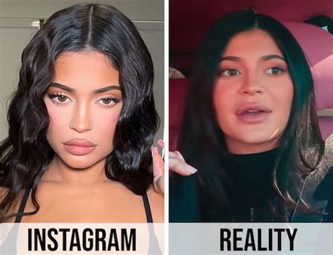kylie jenner had botched breast augmentation surgery cosmetic town