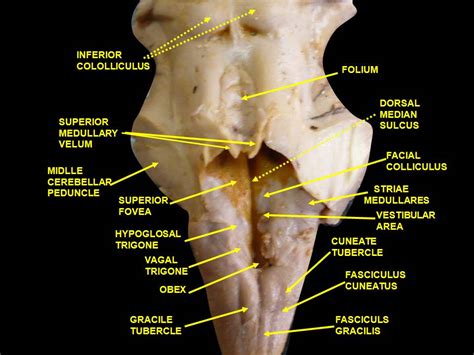 Fourth Ventricle