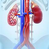Images of How Do Doctors Test For Kidney Infection