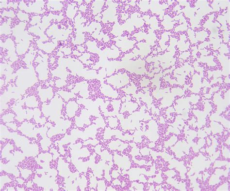 Alcaligenes Faecalis Gram Stain Of A Pure Culture Of Alcal Flickr
