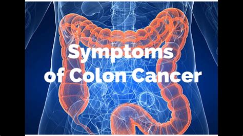 Early Signs Of Colon Disease Recognize Disease