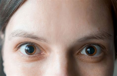 Eye Dilation Faqs What To Know About The Eye Dilation Exam
