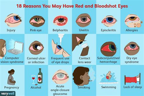 Red Eyes Reasons For Bloodshot Eyes