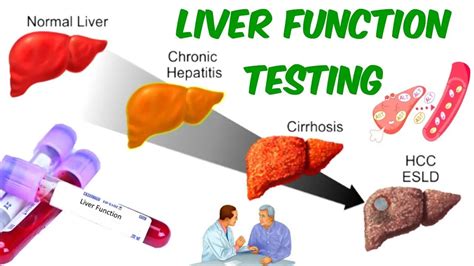 Liver Function Test Results Explained