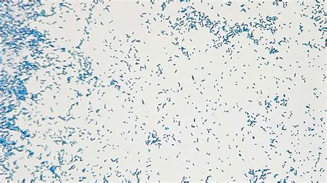 Micrograph Escherichia Coli Methylene Blue 400x P000002 OER Commons