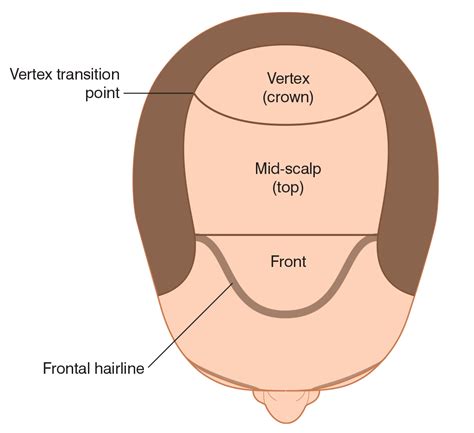 Follicular Unit Hair Transplant 2015