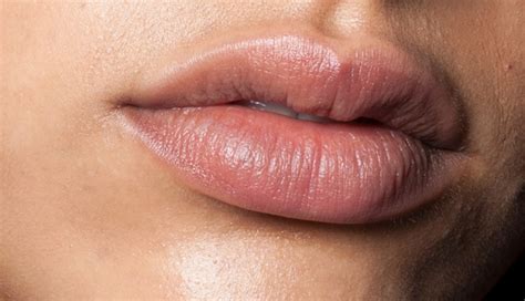 Get Rid Of Dry Skin Around The Lips With These Quick Remedies