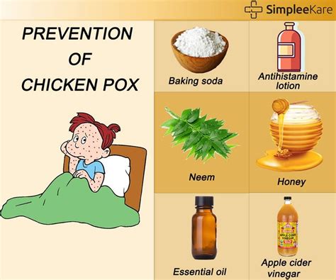 How To Care In Chicken Pox How To Care Info