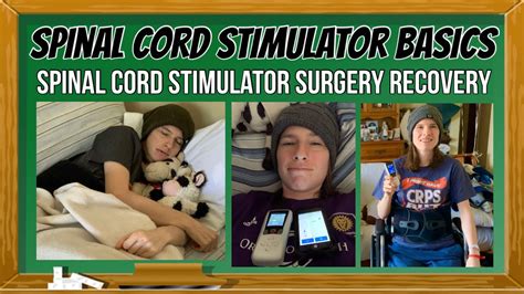 Spinal Cord Stimulator Surgery Recovery Experience Youtube