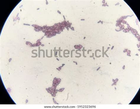 Bacillus Sp Endospore Microscope Stock Photo 1952323696 Shutterstock
