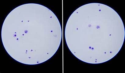 Chromosome Microscope Under Chromosomes Cell Human Division