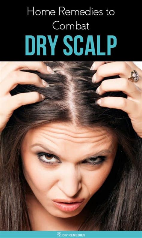 Home Remedies To Combat Dry Scalp