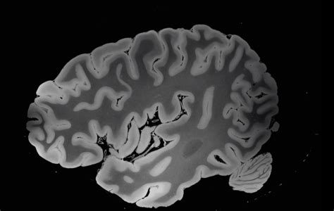 Viewdownload The Highest Resolution Mri Scan Of A Human Brain