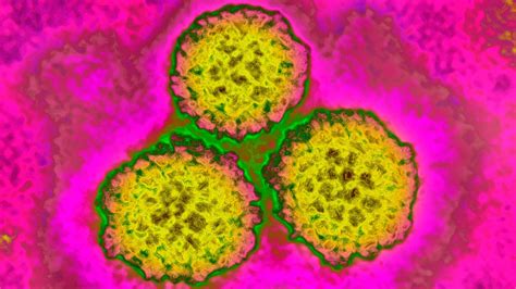 Hpv Vaccine Reduced Cervical Cancer Rates By 87 In Women Study Finds