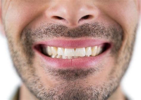 What Is Bruxism And How To Stop Grinding Teeth 🦷
