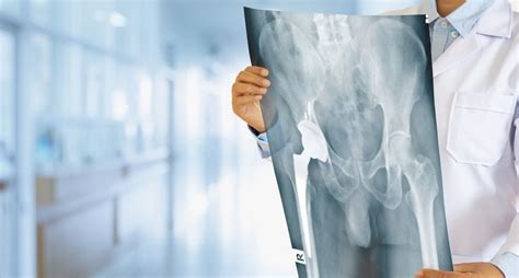 Hip Replacement Surgery Purpose Preparation And Recovery Activebeat